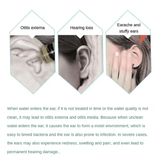 سدادة الأذن اللاصقة (20 قطعة) - IDEA